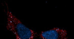 Mitochondria are the canary in the coal mine for cellular stress