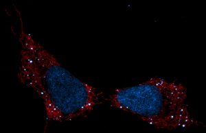 Mitochondria are the ‘canary in the coal mine’ for cellular stress Mitochondria are the canary in the coal mine for cellular stress