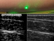 Researchers produce first laser ultrasound images of humans