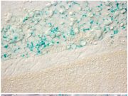 Fat cells can sense sunlight—not getting enough increases metabolic syndrome risk