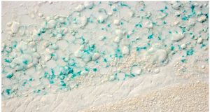 Fat cells can sense sunlight—not getting enough increases metabolic syndrome risk