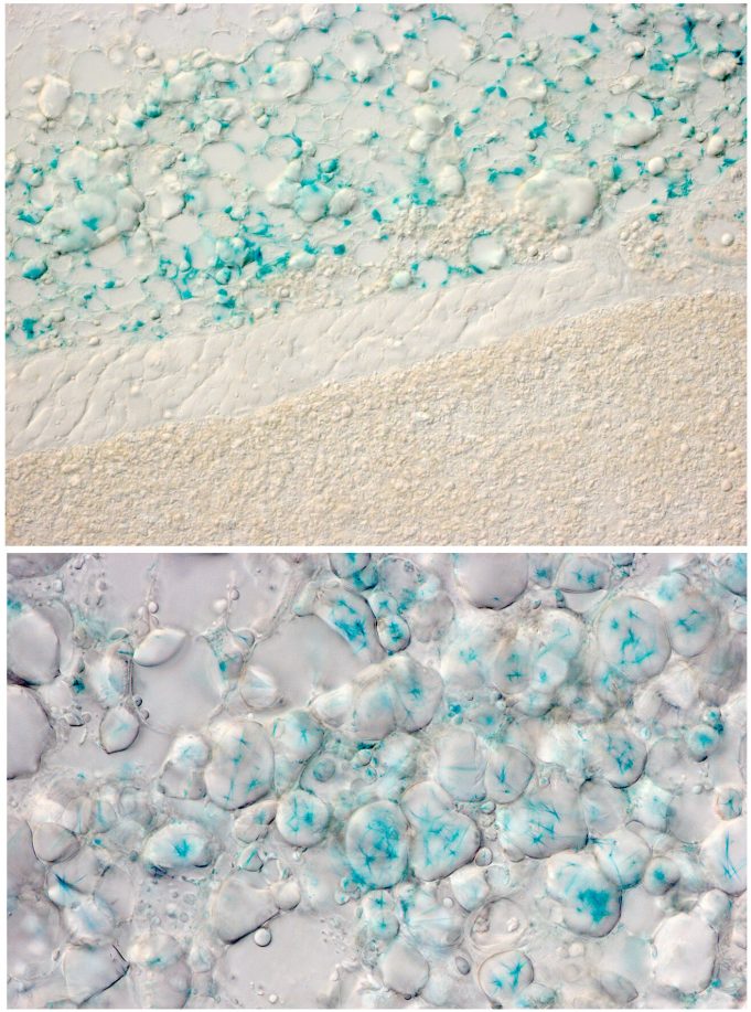 Fat cells can sense sunlight—not getting enough increases metabolic syndrome risk Fat cells can sense sunlight—not getting enough increases metabolic syndrome risk