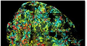 Human immune cells produced in a dish in world first