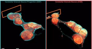 Microscopy technique reveals cells 3 D ultrastructure in new detail
