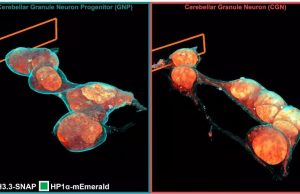 Microscopy technique reveals cells’ 3-D ultrastructure in new detail Microscopy technique reveals cells 3 D ultrastructure in new detail