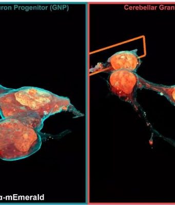 Microscopy technique reveals cells’ 3-D ultrastructure in new detail Microscopy technique reveals cells 3 D ultrastructure in new detail