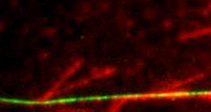 Researchers unlock secrets of cell division define role for protein elevated in cancer