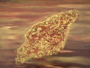Tuberculosis bacteria survive in amoebae found in soil