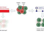 Ultrasound selectively damages cancer cells when tuned to correct frequencies