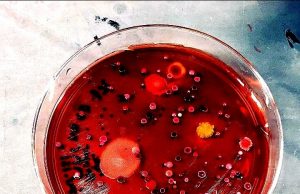 One quarter of bacterial pathogens can spread antibiotic resistance directly to peers One quarter of bacterial pathogens can spread antibiotic resistance directly to peers