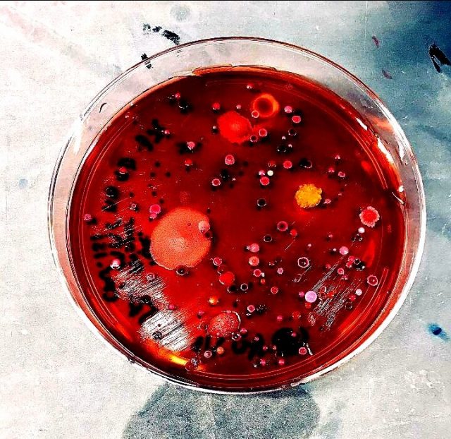 One quarter of bacterial pathogens can spread antibiotic resistance directly to peers One quarter of bacterial pathogens can spread antibiotic resistance directly to peers