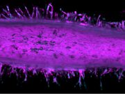 Pancreatic cancer time machine exposes plot twist in cell growth and invasion