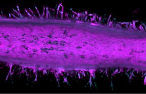 Pancreatic cancer ‘time machine’ exposes plot twist in cell growth and invasion Pancreatic cancer time machine exposes plot twist in cell growth and invasion