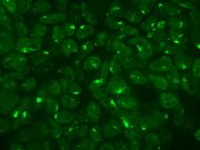 Scientists explore how females shut off their second X chromosome