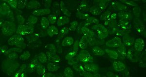 Scientists explore how females shut off their second X chromosome
