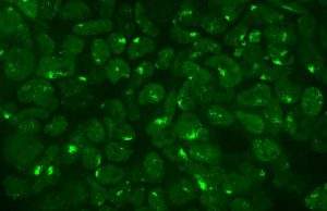 Scientists explore how females shut off their second X chromosome Scientists explore how females shut off their second X chromosome