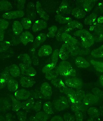 Scientists explore how females shut off their second X chromosome