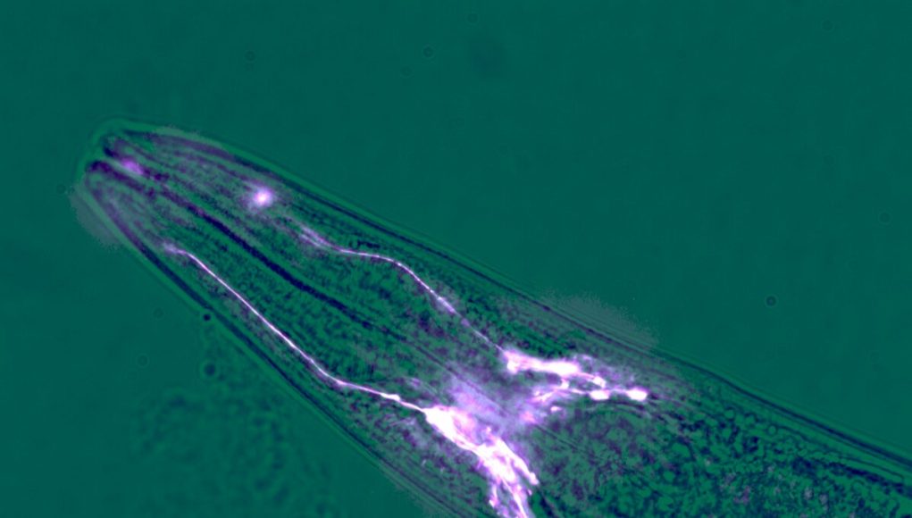 Brain cells protect muscles from wasting away