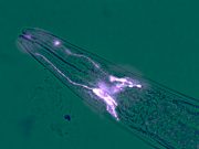 Brain cells protect muscles from wasting away