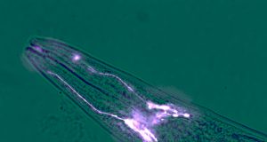 Brain cells protect muscles from wasting away