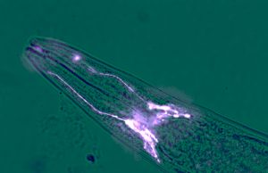 Brain cells protect muscles from wasting away Brain cells protect muscles from wasting away