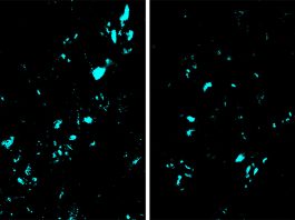 New CRISPR base editing technology slows ALS progression in mice