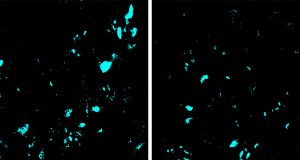New CRISPR base editing technology slows ALS progression in mice
