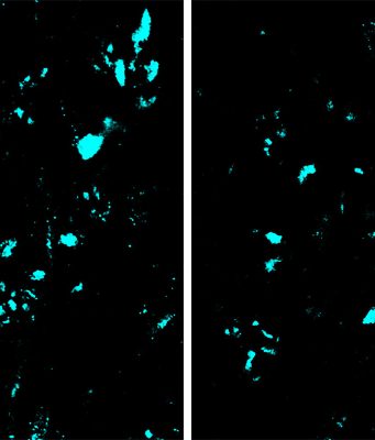 New CRISPR base editing technology slows ALS progression in mice
