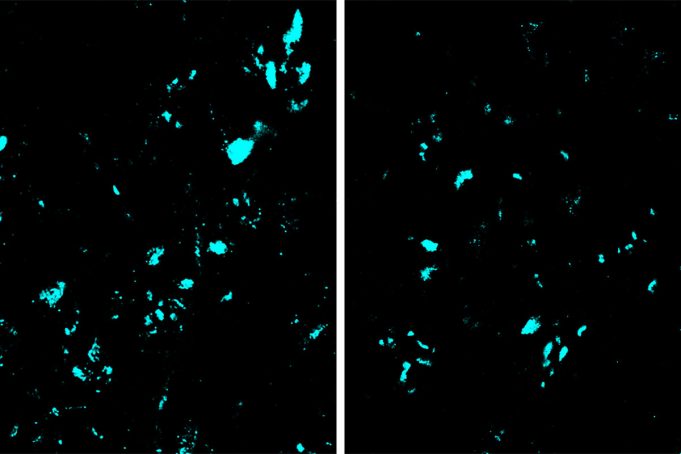 New CRISPR base-editing technology slows ALS progression in mice New CRISPR base editing technology slows ALS progression in mice