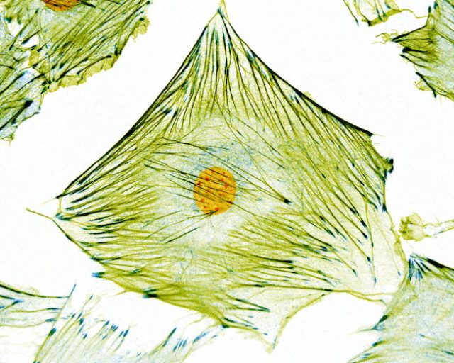 New microscopy technique uncovers previously hidden information in micrographs of biological cells