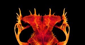 Skulls gone wild How and why some frogs evolved extreme heads
