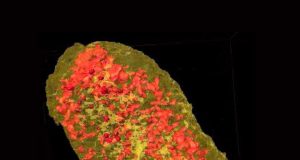 Cell membrane proteins imaged in 3 D