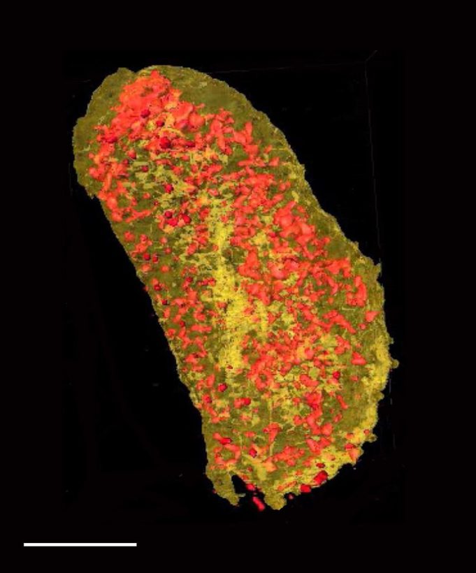 Cell membrane proteins imaged in 3 D