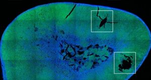 Researchers achieve remote control of hormone release using magnetic nanoparticles