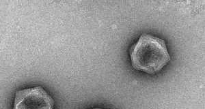 Viruses dont have a metabolism but some have the building blocks for one
