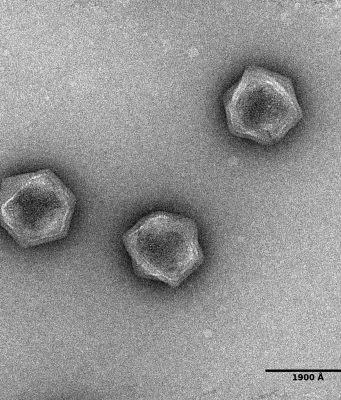 Viruses dont have a metabolism but some have the building blocks for one