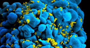 Work on rare molecule aims to enhance cell therapy and deliver functional cure for HIV