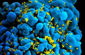 Work on rare molecule aims to enhance cell therapy and deliver functional cure for HIV Work on rare molecule aims to enhance cell therapy and deliver functional cure for HIV