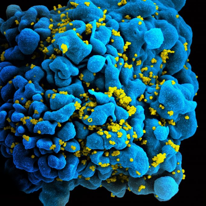Work on rare molecule aims to enhance cell therapy and deliver functional cure for HIV