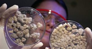 Change of direction in immune defense Frankincense reprograms inflammatory enzyme