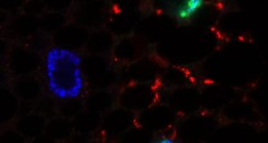 Scientists discover how cells respond to fasting