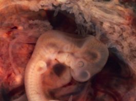 Unique insight into development of the human brain Model of the early embryonic brain