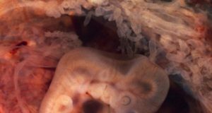Unique insight into development of the human brain Model of the early embryonic brain