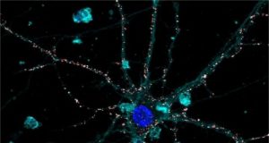 Nanotechnology applied to medicine The first liquid retina prosthesis