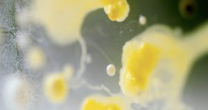 Pioneering research reveals certain human genes relate to gut bacteria