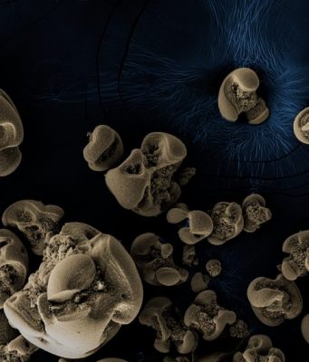 Bacteria with a metal diet discovered in dirty glassware Bacteria with a metal diet discovered in dirty glassware