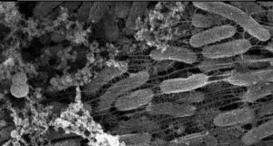 Metal breathing bacteria could transform electronics biosensors and more