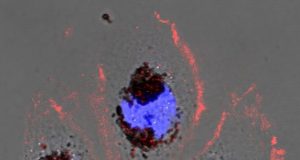 New biomaterial could shield against harmful radiation