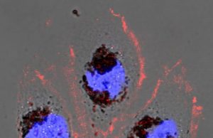 New biomaterial could shield against harmful radiation