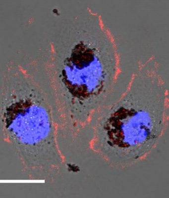 New biomaterial could shield against harmful radiation